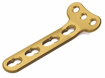 PLACAS  RADIO DISTAL